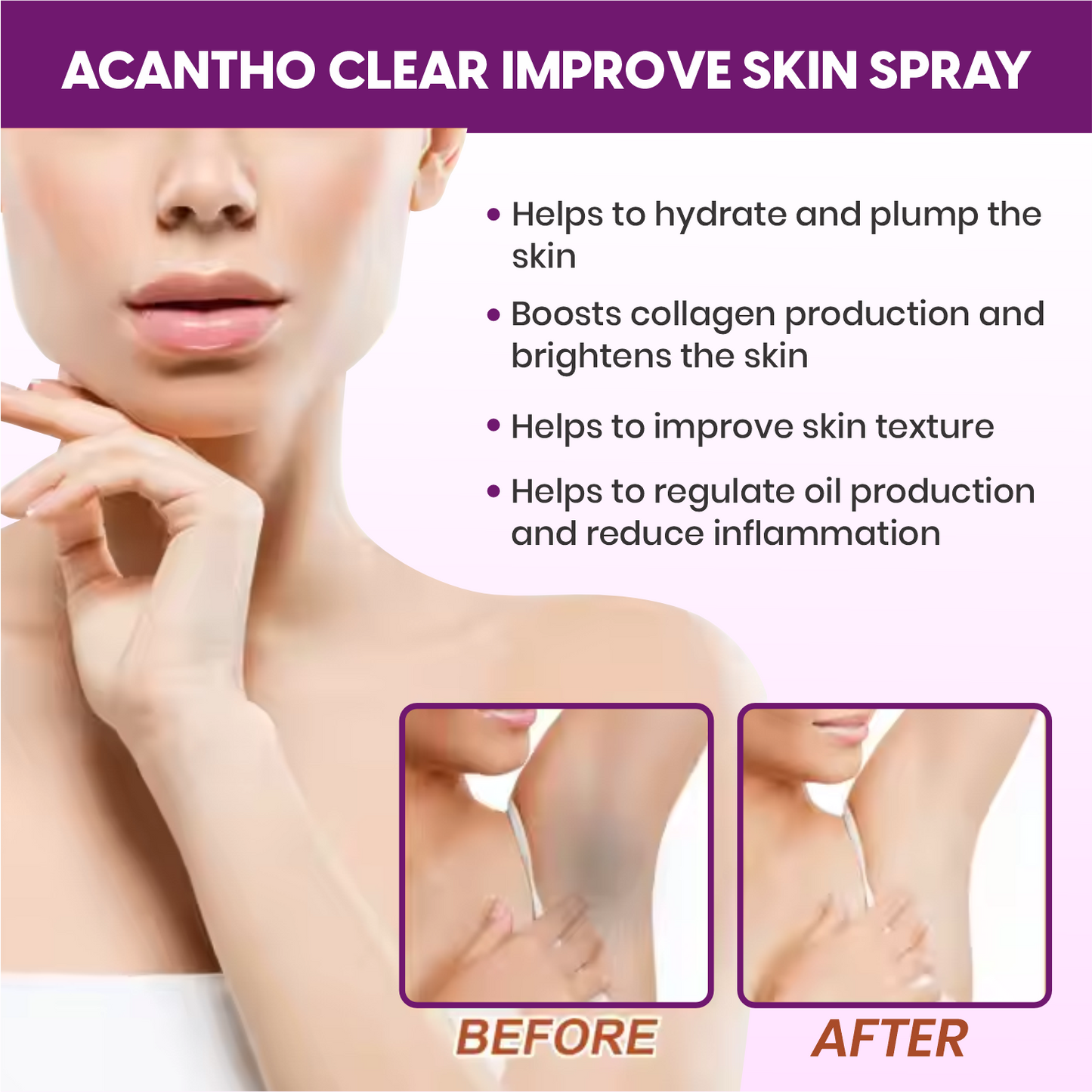 Healncure Acantho Cream – Retinol, Lactic Acid & Urea – For Skin Discoloration – 50 g