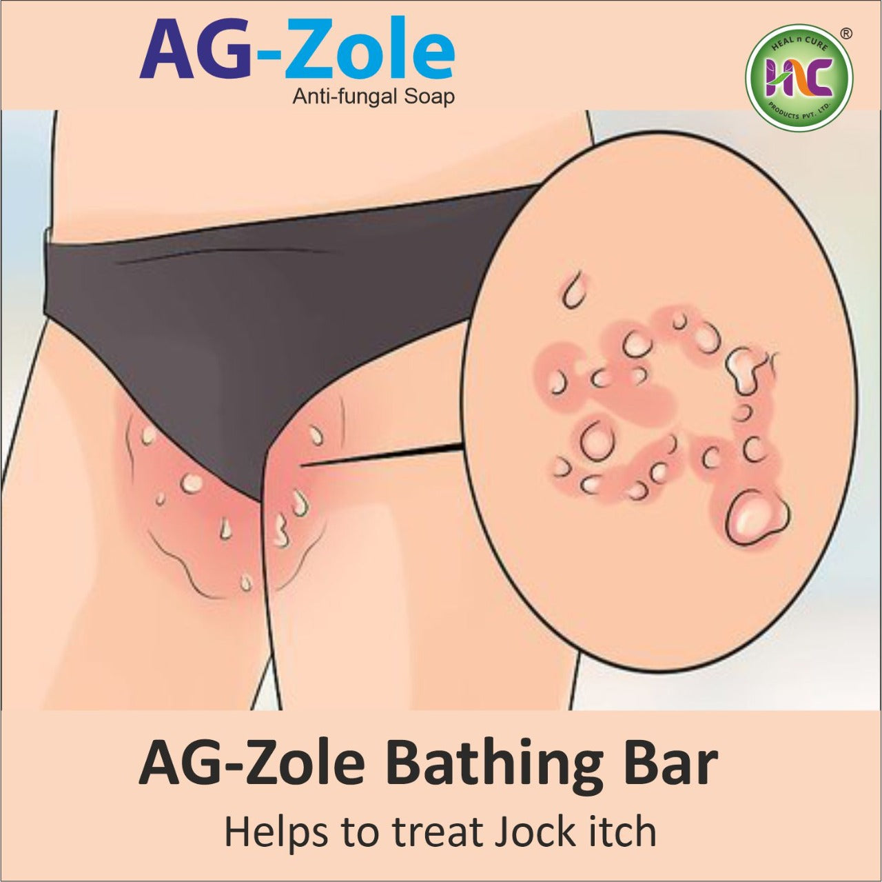 Antifungal Soap ,AG Zole