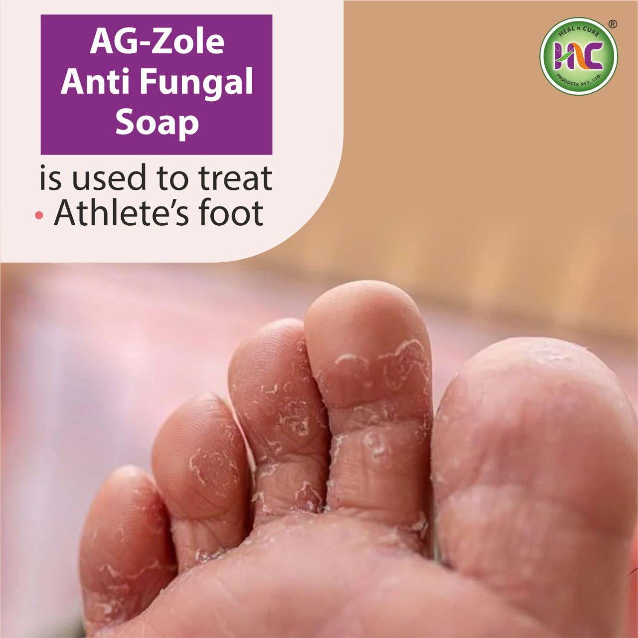 Antifungal Soap ,AG Zole